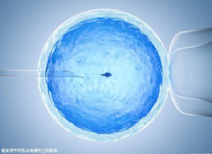 PGT三代试管
